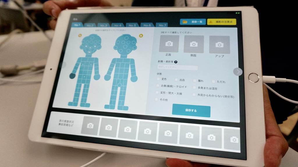 産業技術総合研究所が開発した児童虐待への対応を支援するアプリの画面。けがなどの情報を入力し、人工知能が危険度を予測する(松田麻希撮影)