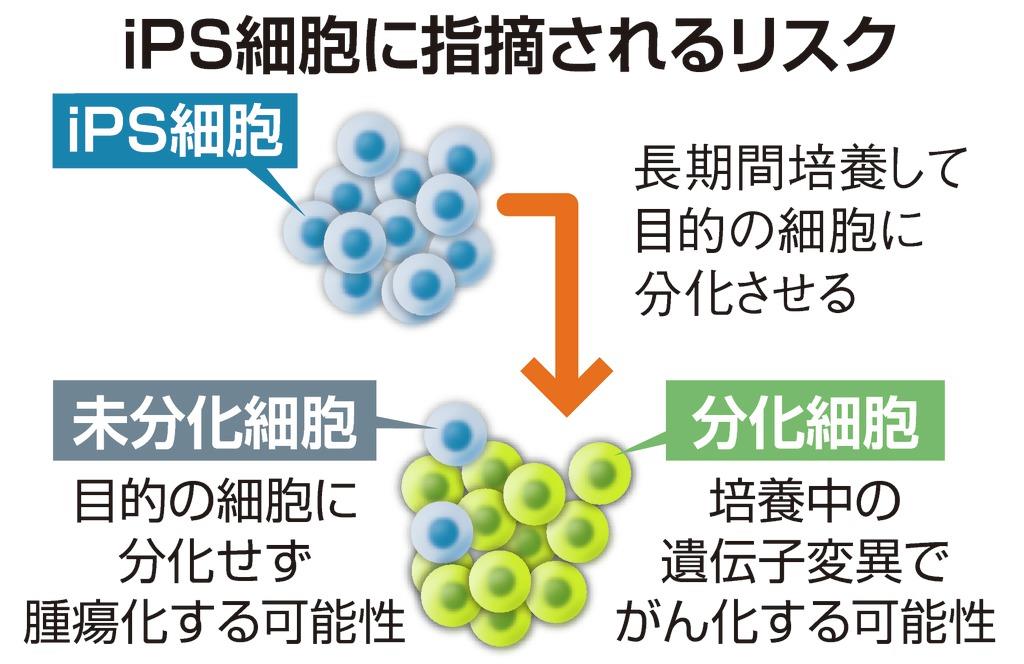 ｉＰＳ細胞に指摘されるリスク